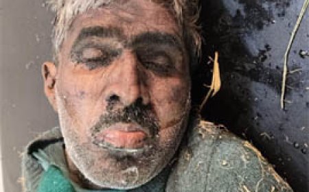 जसपुर के कलियावाला रोड पर मिले 55 साल के व्यक्ति की मौत